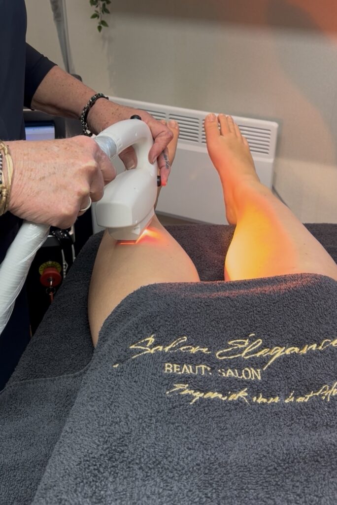 IPL Intensed Pulsed Light - Salon Elegance Enschede